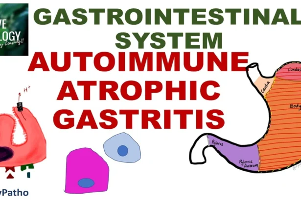 autoimmune gastritis bryan johnson