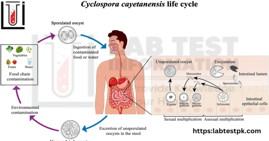 cyclosporiasis