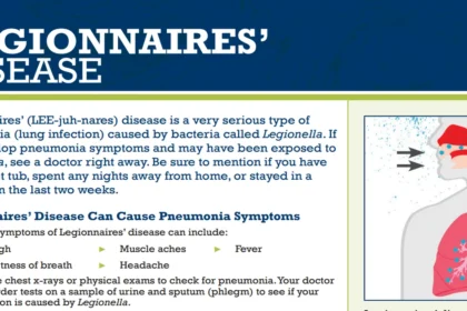 legionnaires disease